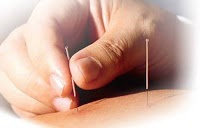 Kate Winstanley Acupuncture London   Chelsea Clinic 727383 Image 2